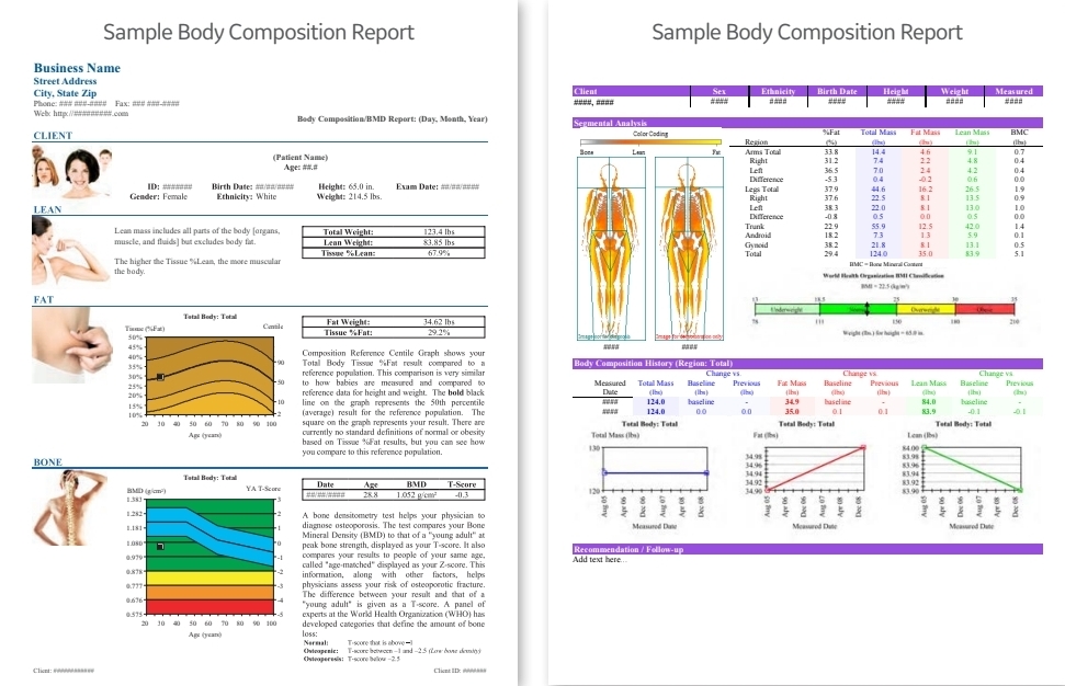Body scan results showing detailed wellness analysis