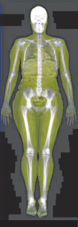 Body scan displaying muscle mass analysis